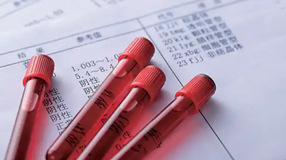 血常规有问题不代表患有白血病热搜配图